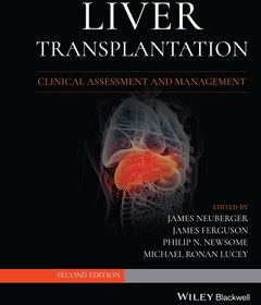 تصویر پیوند کبد: ارزیابی و مدیریت بالینی ۲۰۲۱ Liver Transplantation: Clinical Assessment and Management 2021