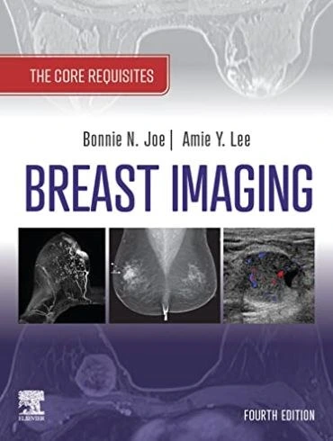 خرید و قیمت دانلود كتاب Breast Imaging: The Core Requisites 4th Edition ...