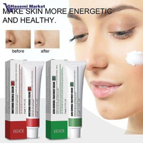 تصویر کرم ضد جوش ایلهو EELHOE Acne Removal Treatment Cream