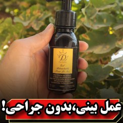 تصویر ژل کوچک کننده بینی دکس لاند 