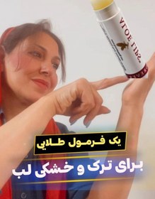 تصویر نرم کننده پوست لب Forever Aloe Lips With Jojoba