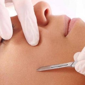 تصویر کیت درماپلنینگ بسته 100 عددی 