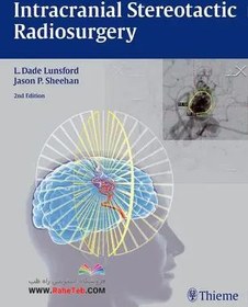 تصویر Intracranial Stereotactic Radiosurgery 2015رادیوسرجری استریوتاکتیک داخل جمجمه ای 