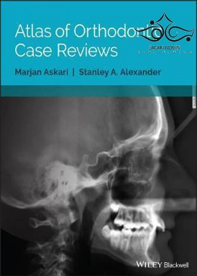 خرید و قیمت Atlas of Orthodontic Case Reviews, 1st Edition2017 اطلس ...