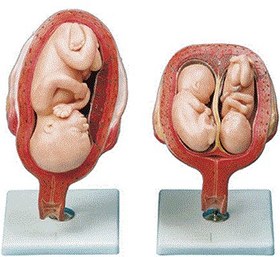 تصویر مولاژ مراحل حاملگی 