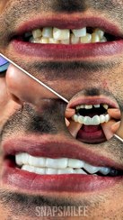 تصویر اسنپ اسمایل رنگ سفید تایوانی 