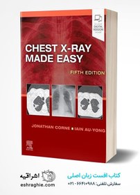 تصویر Chest X-Ray Made Easy 2022 