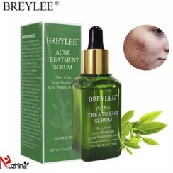 تصویر سرم ضد جوش چای سبز بریلی BREYLEE BREYLEE Green Tea Anti-Acne Serum