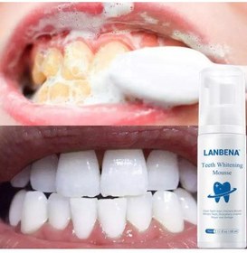 تصویر موس سفید کننده و ضد پلاک دندان لانبنا LANBENA Teeth Whitening Mousse 