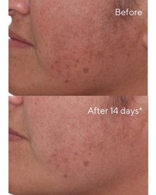 تصویر سرم برطرف کننده لک سریع مورد -rapid correcting dark spot murad 