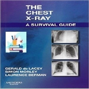 خرید و قیمت The Chest X-Ray TRUE PDF price 1€ | ترب