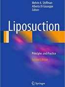 تصویر دانلود کتاب Liposuction: Principles and Practice 2nd Edition 