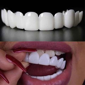 تصویر لمینت متحرک دندان ترو اسمایل true smile مجموعه 10 عددی 