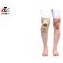 تصویر زانوبند کشکک باز فنردار نئوپرن آدور Ador Open patella knee brace with neoprene spring