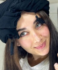 تصویر لنز رنگی یونیک آلاماندا 