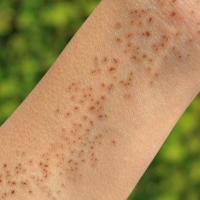 تصویر استیکر کک و مک طبیعی 