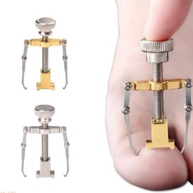 تصویر ارتودنسی ناخن فلزی 