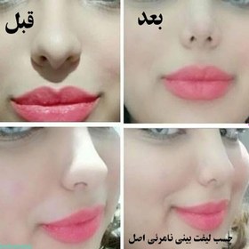 تصویر چسب لیفت بینی Nose lift glue