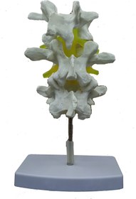 تصویر مولاژ مهره های دیسک 