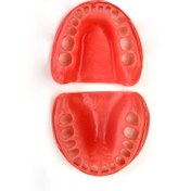 تصویر لثه یدکی دو فک (بافت نرم یدکی تمامی فک‌ها) 