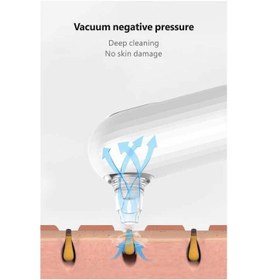 تصویر میکرودرم استس بیوتی مدل GB-4706 - سفید 