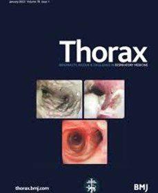 تصویر مجله Thorax 