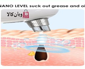 تصویر میکرودرم پرتابل آبی به عبارتی (آبریژن) 