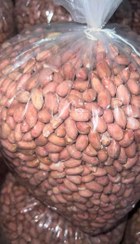 تصویر مغز لوکس 5 کیلویی 