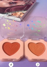 تصویر رژگونه آنالیدی - 04 