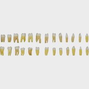 تصویر ست دندان ریشه دار تعویضی فک پریو حاس 
