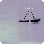 تصویر پروتئین نوترکیب (10nanogram) La/SSB Human 