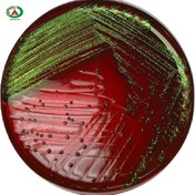 تصویر سوش میکروبی اشریشیاکلی 