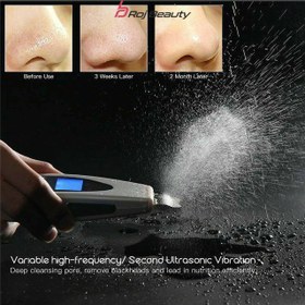 تصویر دستگاه اتوی صورت و بدن درما اف مدل LW-006 ا Skin Cleaner LW-006 Skin Cleaner LW-006
