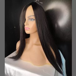 تصویر پروتز کفسری - خرمایی 