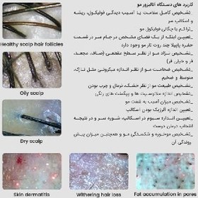 تصویر درماتوسکوپ Dermatoscope 