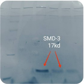 تصویر پروتئین نوترکیب (100nanogram) Smith Ag-۳ 