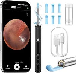 تصویر گوش پاک کن هوشمند دوربین دار برند OUTACT OUTACT Ear Wax Removal Cleaner Wireless 360° Visible Ear Camera with WiFi Ear Pick Cleaning Kit Suitable for Ear, Nose, Skin, Pets, Lover Gift for Family