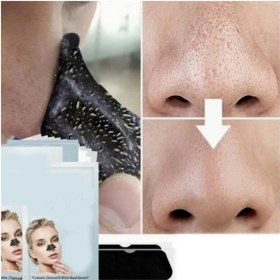 تصویر چسب پاک کننده بینی ویت چسب-پاک-کننده-بینی-ویت