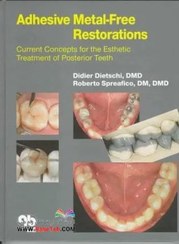 تصویر Adhesive Metal-Free Restorations : Current Concepts in the Aesthetic Treatment of Posterior Teethترمیم های بدون فلز چسب 