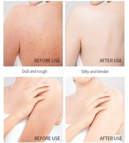 تصویر نمک بدن AHA