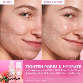 تصویر تونر کوچک کننده منافذ و آبرسان هندوانه گلو رسپی 