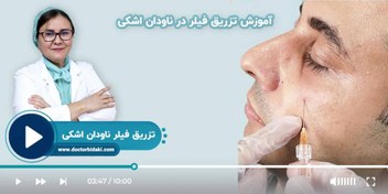 تصویر مینی دوره تزریق فیلر زیر چشم 