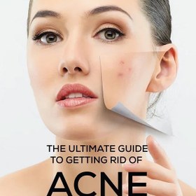 تصویر پن ضد لک و روشن کننده قوی صورت و گردن برند ACM فرانسه وزن 100 گرم 