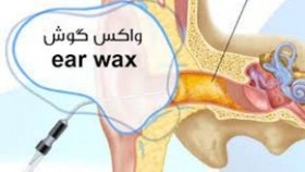 تصویر واکس گوش(Ear Wax) 
