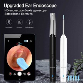 تصویر گوش پاک کن هوشمند گرین Visual Earwax Removal Tool Visual Earwax Removal Tool