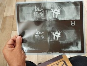 تصویر پایه نت رهبری گراویتی 