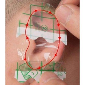 تصویر چسب گوش 10 عددی 