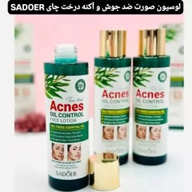 تصویر لوسیون ضد جوش و آکنه تی تری SADOER 