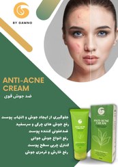 تصویر کرم آنتی آکنه و ضد جوش حرفه ای Anti_Acne