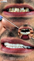 تصویر خمیر اسنپ اسمایل دو فک 